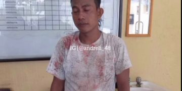 Intip Isteri sedang Enak-enak dengan Selingkuhannya, Suami Kalap Bacok Keduanya Hingga Kritis