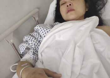 Tragis, PMI Asal Sukabumi Dirawat Intensif di RS, Usai Disiksa Majikan di Dubai